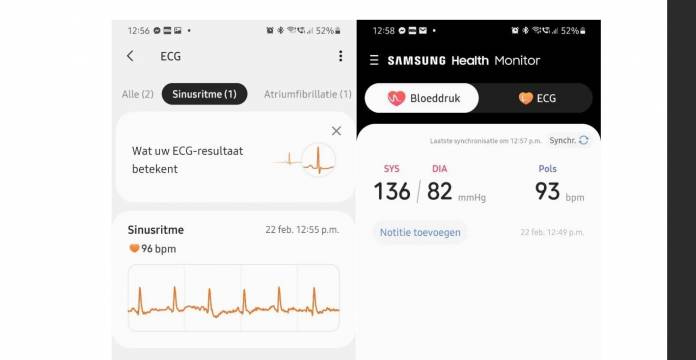 Galaxy watch active discount 2 ecg update 2021